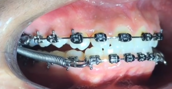 Ekran Görüntüsü (13)