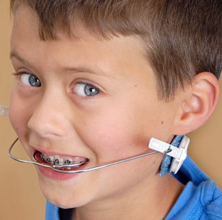 orthodontic-headgear.jpg